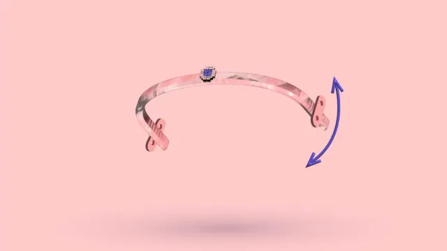 Bar Movement After Nuss Procedure: Should You Worry?