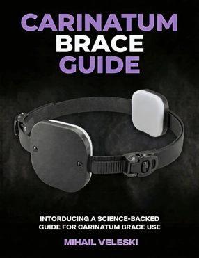 Carinatum Brace Guide cover