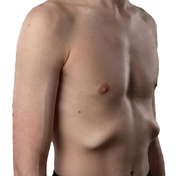 A ribcage with the lower ribs flaring outward