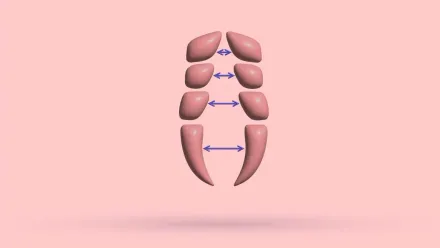 Diastasis Recti And Pectus Excavatum: Studies + Tips
