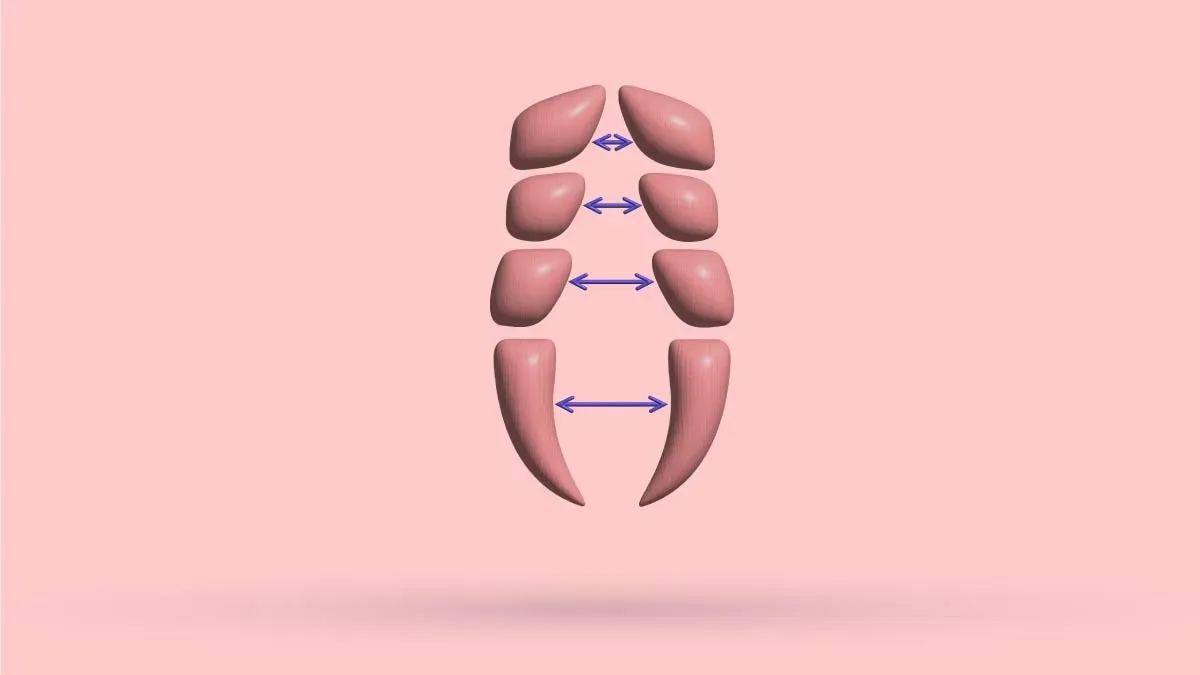 Diastasis Recti And Pectus Excavatum: Studies + Tips