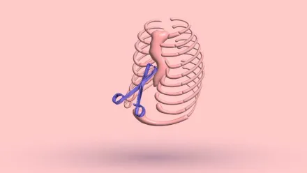 Does Pectus Excavatum Go Away On Its Own?: What To Do