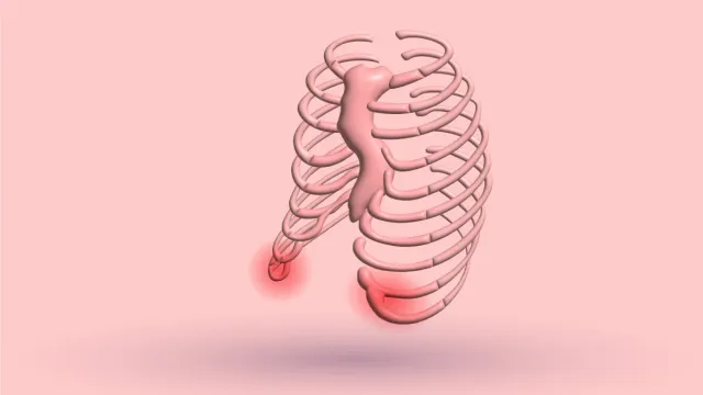 How To Fix Flared Ribs: Causes, Exercises & More