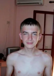 Mihail as a young teenager before puberty, sunken chest visible