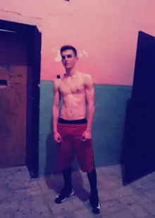 Mihail at 15, around the time he was diagnosed with pectus excavatum
