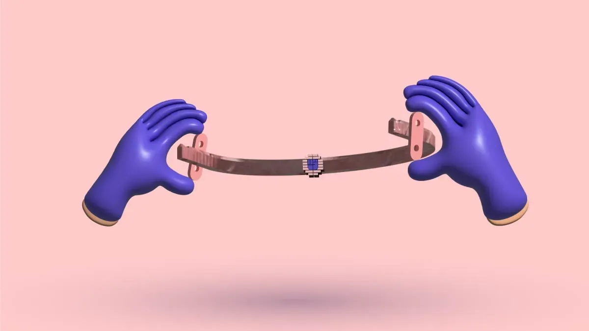 Nuss Procedure For Pectus Excavatum: Essential: Guide