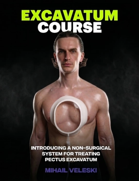 Pectus Excavatum Course cover