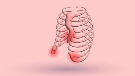 Pectus Excavatum Pain In Chest, Back, Rib: How To Cope