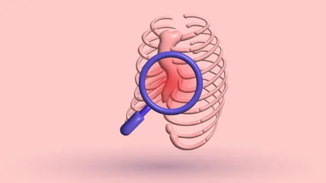 12 Pectus Excavatum Symptoms: Physical & Mental