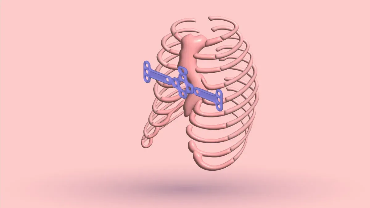 Pectus Up Surgery: Ultimate: Guide + Cost, Risk & More