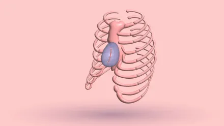 Pectus Excavatum Implants: 5 Types, Benefits & Cost