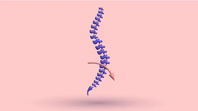 A 3D spine seen from the side with an arrow curving forward at the lower back