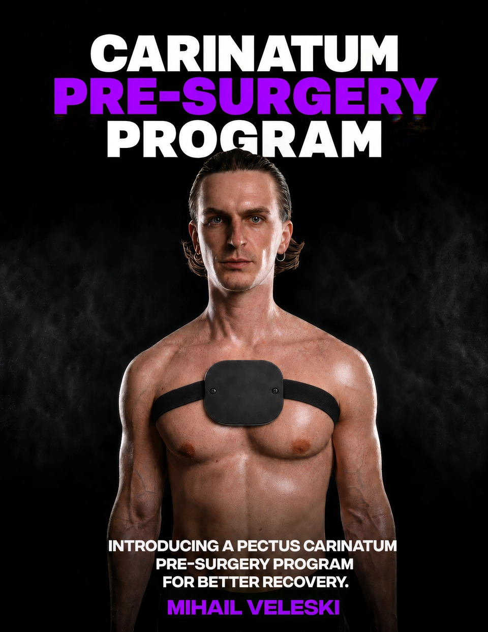Pectus Carinatum Pre-Surgery Program cover