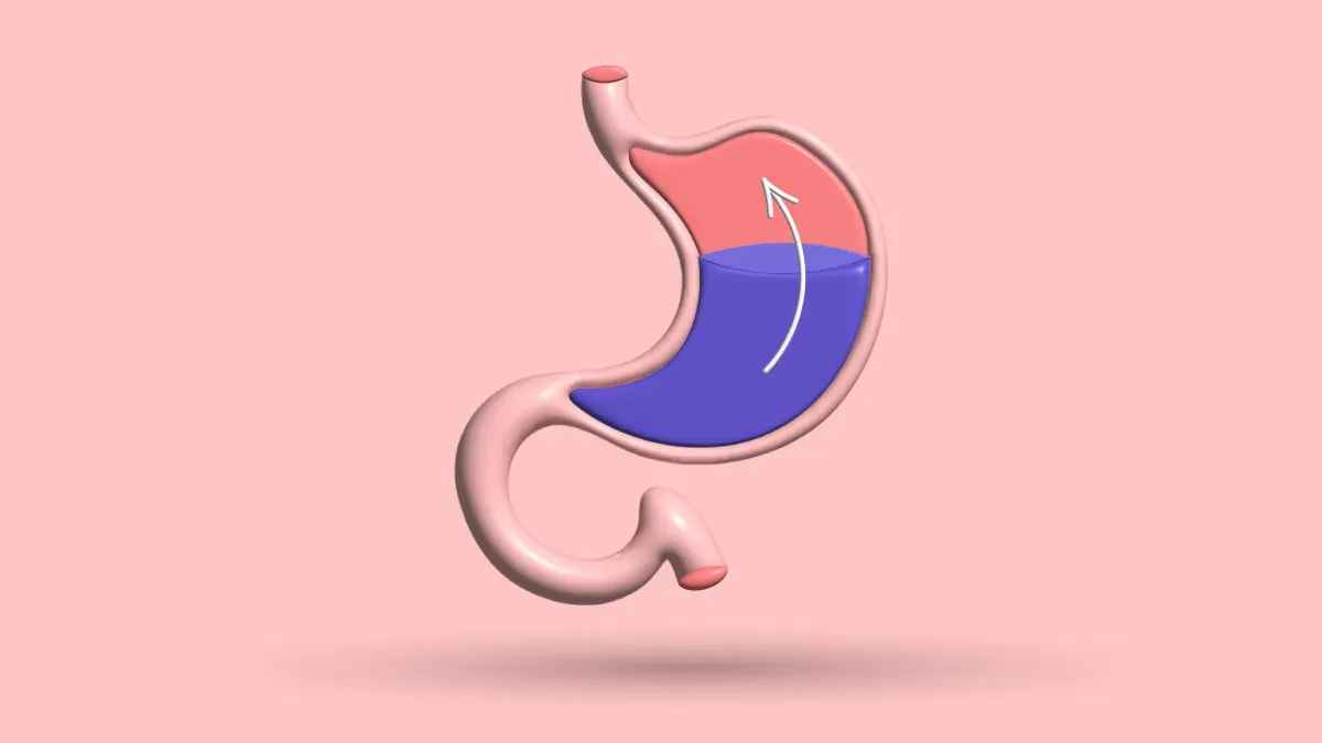 Pectus Excavatum Puking & Acid Reflux Prevention