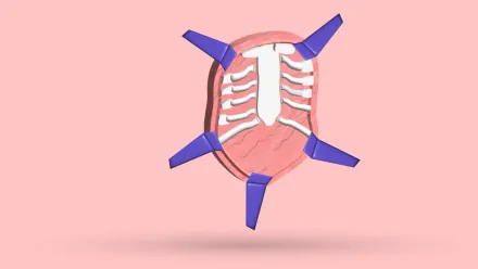 Ravitch Procedure For Pectus Excavatum: A-Z Guide