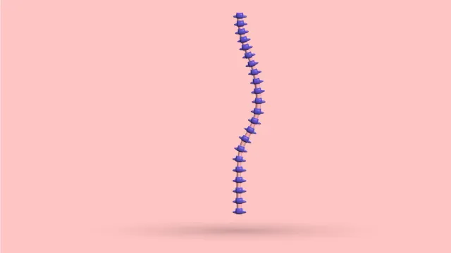A 3D spine curving sideways in an S shape