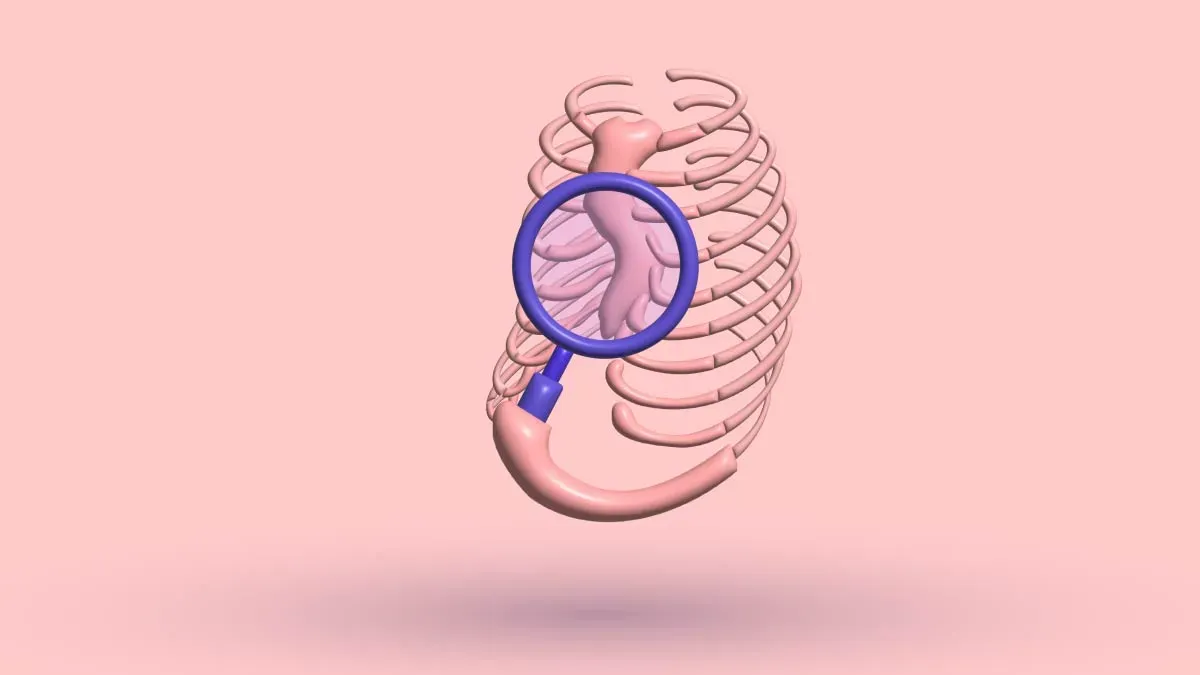 Can You Self-Diagnose Pectus Excavatum Visually?: Tips
