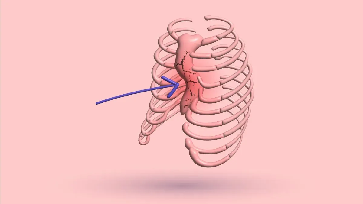 Sternum Popping And Pectus Excavatum: 5 Causes + Tip