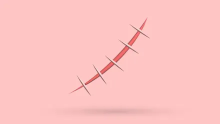 Pectus Excavatum Surgery Scar: 5 Tips To Heal Better