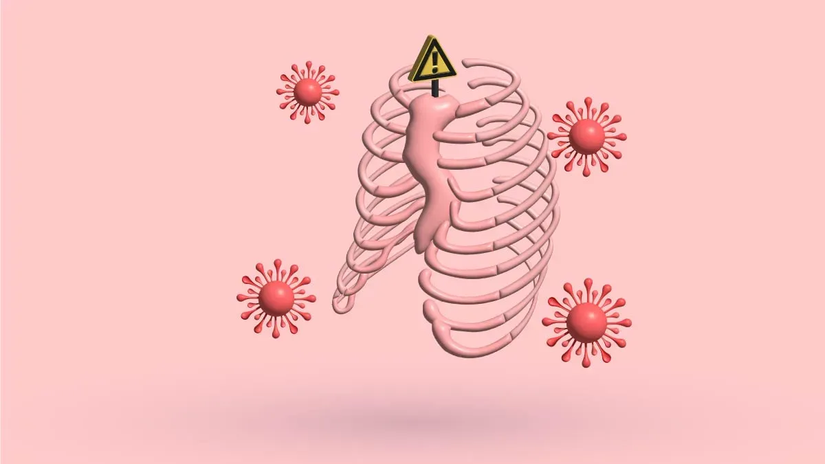 Weakened Immunity And Pectus Excavatum: What To Do