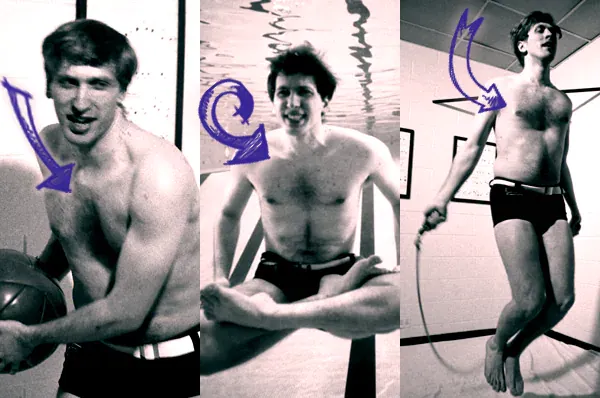 Bobby fischer pectus excavatum chest deformity
