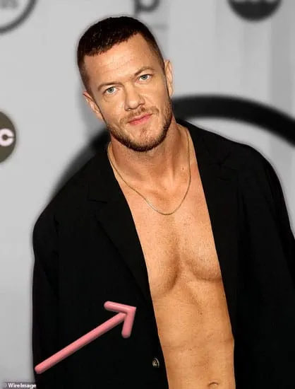 Dan reynolds sunken chest