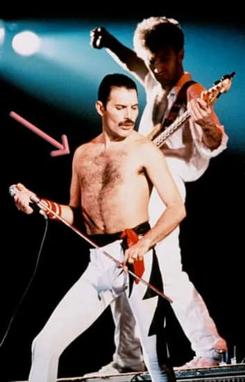 Freddie mercury pectus excavatum