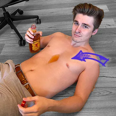 Ludwig anders ahgren pectus excavatum deformity