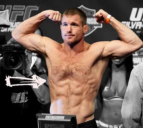 Matt hughes pectus excavatum deformity