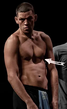 Nate diaz concave chest