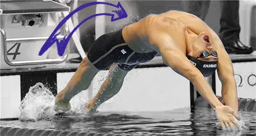 Thomas ceccon pectus excavatum deformity