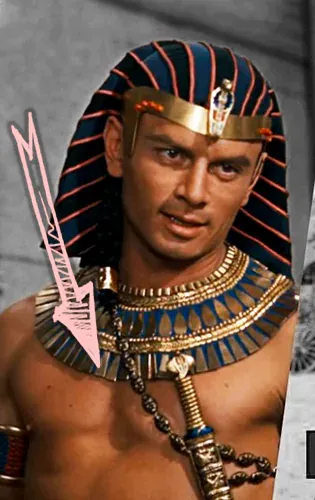 Yul brynner pectus exavatum chest deformity
