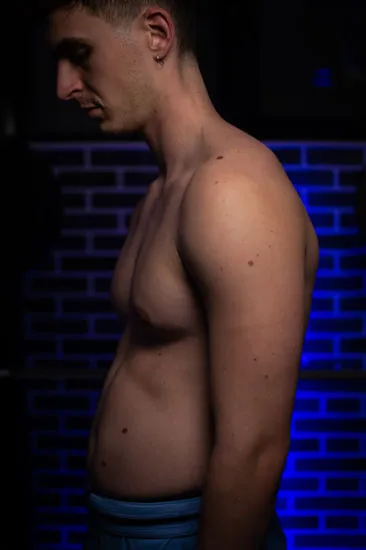 Pectus pot belly worsening appearance