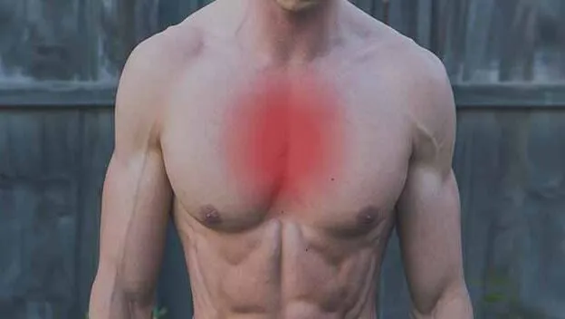 pectus excavatum pain