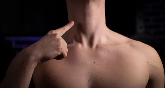 Strengthen neck flexors pectus