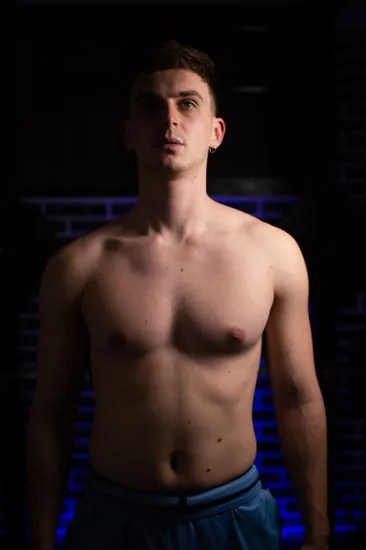 Uneven shoulders pectus