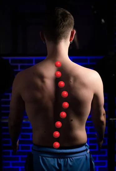 Dextroscoliosis