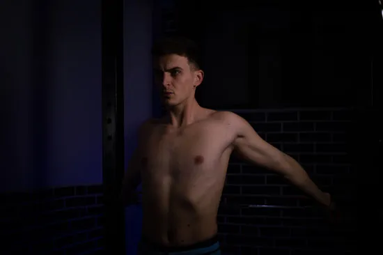 Stretching pectus excavatum