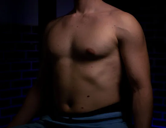 What is pectus excavatum
