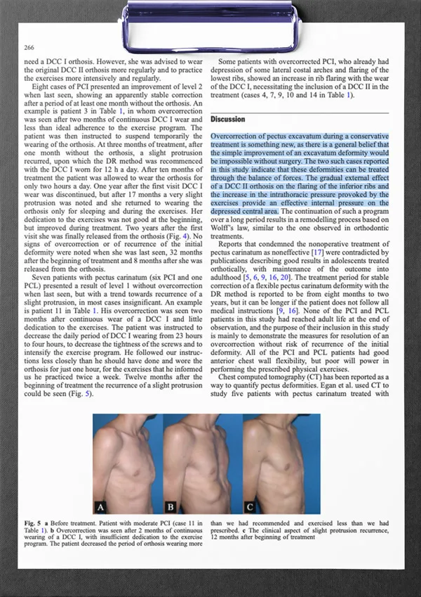 First page of the study: Overcorrection during treatment of pectus deformities with DCC orthoses: experience in 17 cases