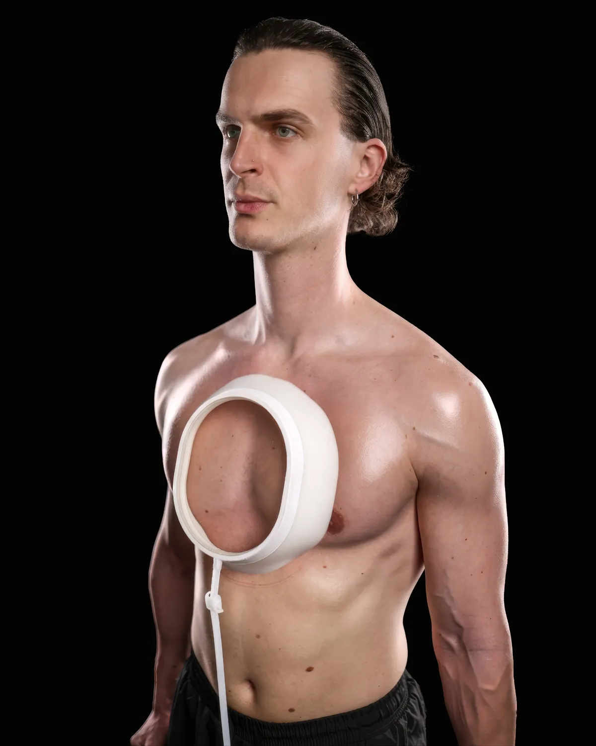 Mihail wearing a vacuum bell device on his chest, side view