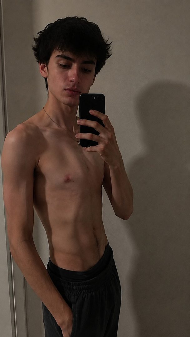 Ethan — pectus carinatum chest before and after 3 months of exercise and 1-on-1 coaching