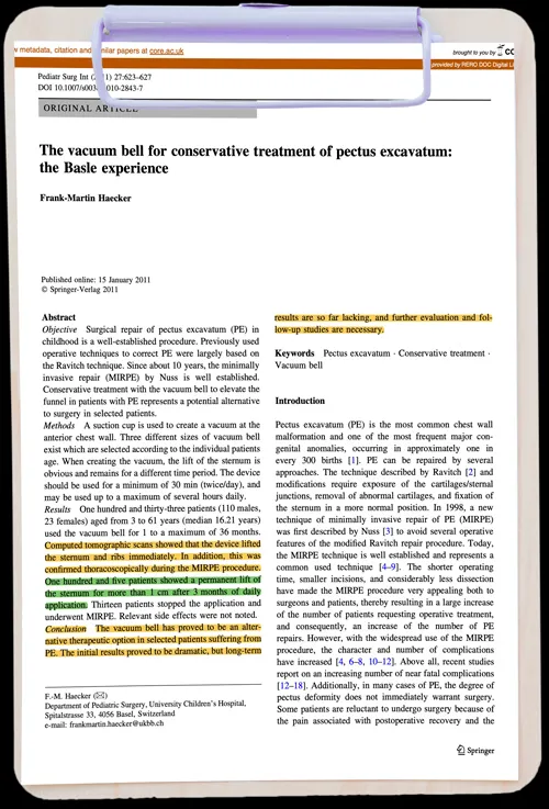 The vacuum bell for conservative treatment of pectus excavatum: the Basle experience