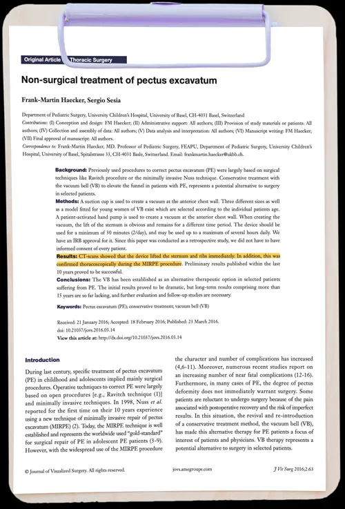 Non-surgical treatment of pectus excavatum