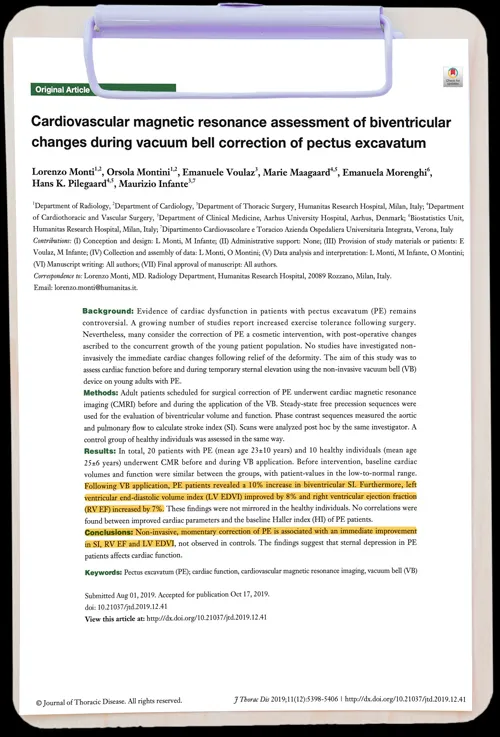 Cardiovascular magnetic resonance assessment of biventricular changes during vacuum bell correction of pectus excavatum