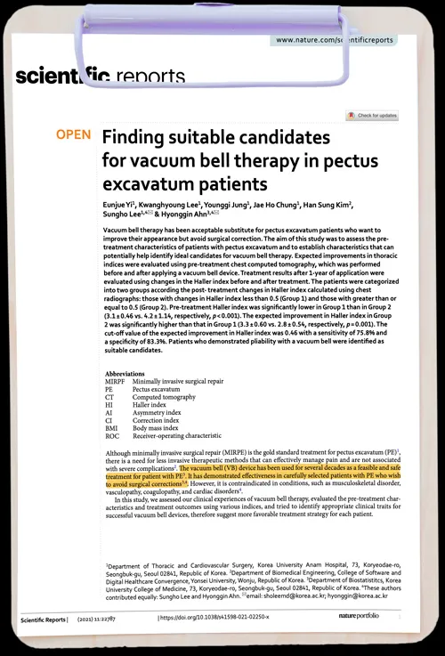 Finding suitable candidates for vacuum bell therapy in pectus excavatum patients